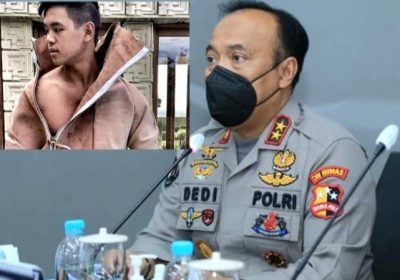 Polri Melacak Dugaan Desainer Terlibat Jual Beli Organ Manusia di Brazil