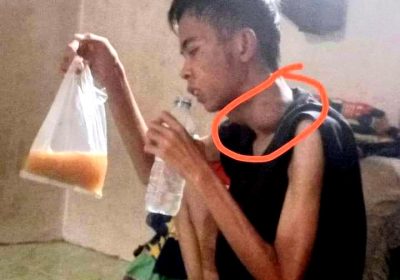Kisah Parmam Didera Penyakit Tak Bisa Selesaikan Kuliah di Universitas Negeri Padang