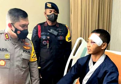 Kapolda Metro Jaya Jenguk 6 Anggota Polisi Terluka Saat Demo di DPR