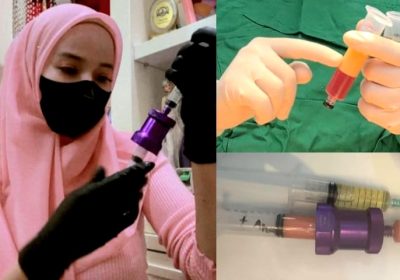 dr Ayu Widyaningrum Temukan Teknologi Treatment Kecantikan Terbaru dengan Fat Filler