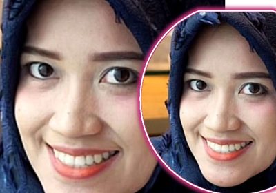 Dokter Resti Apriani Ditetapkan Tersangka Perdana Kasus Pencemaran Nama Baik Putri Dakka